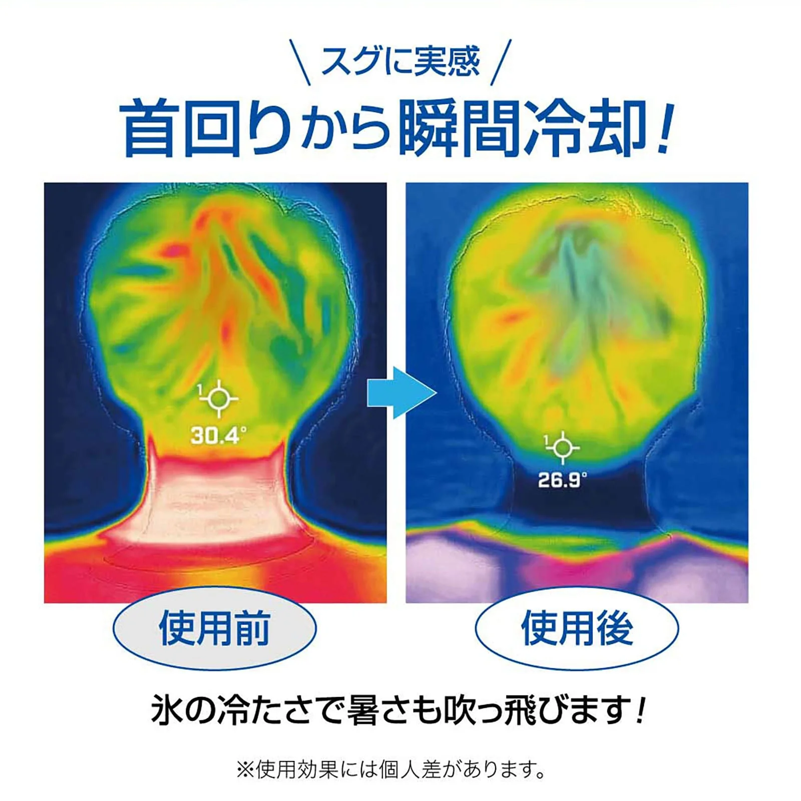 U-COOL / Neck Ice Pack / Blue - Image 5